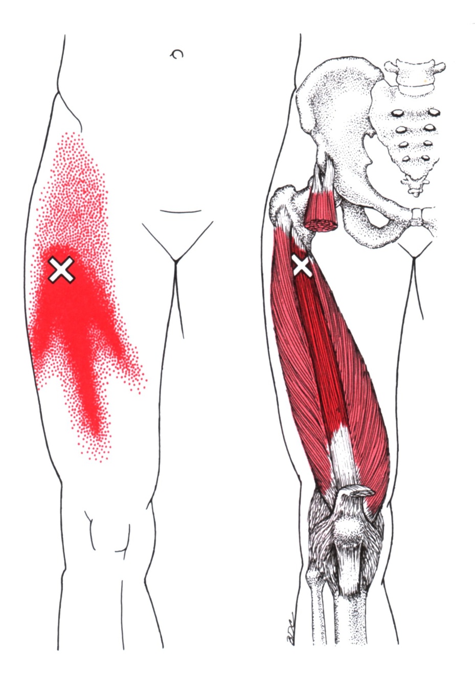 What Nerve Causes Pain In Front Of Thigh At Ronald Diggs Blog